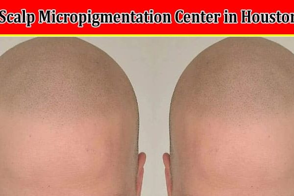 How to Finding a Scalp Micropigmentation Center in Houston
