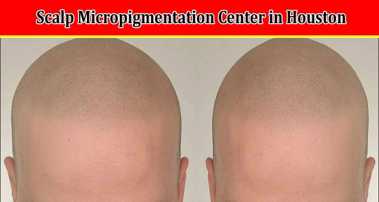 How to Finding a Scalp Micropigmentation Center in Houston